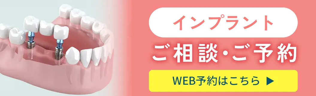 インプラントのご相談・ご予約はこちら